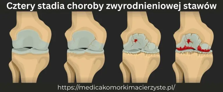 zwyrodnieniowej