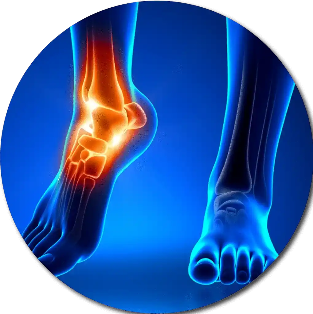 Foot and Ankle