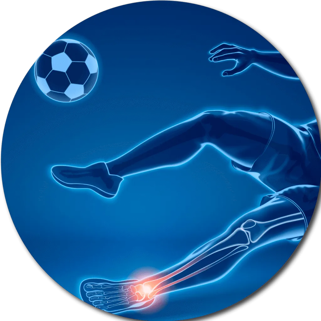 Sports Injury